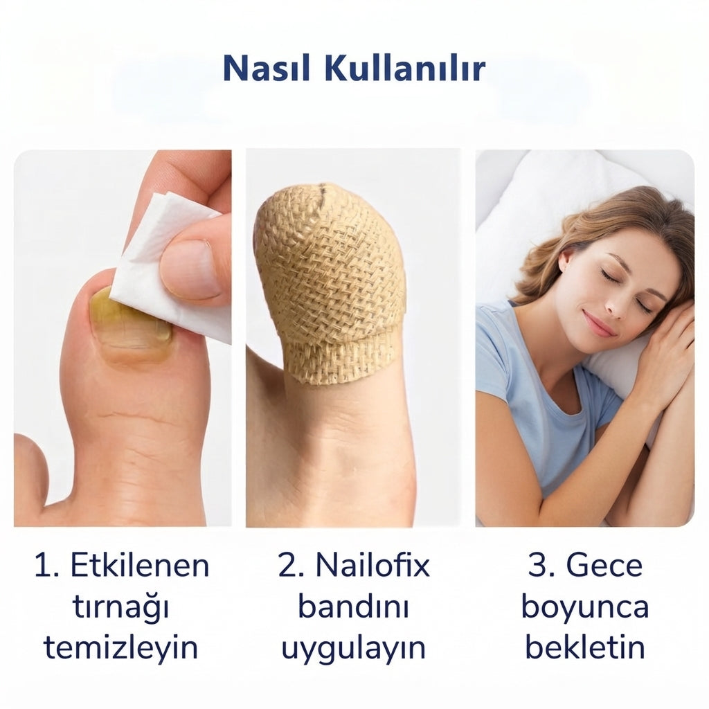 Nailofix® Mantarlı Tırnak Bakım Bandı