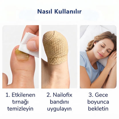 Nailofix® Mantarlı Tırnak Bakım Bandı
