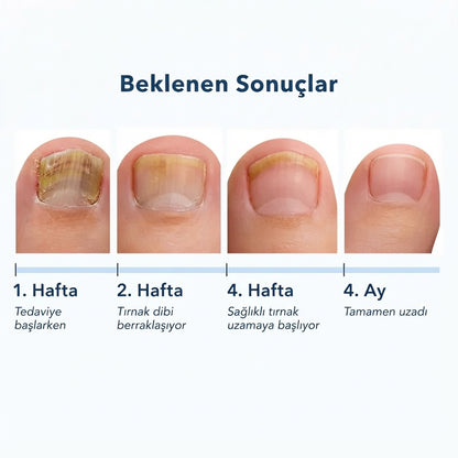 Nailofix® Mantarlı Tırnak Bakım Bandı