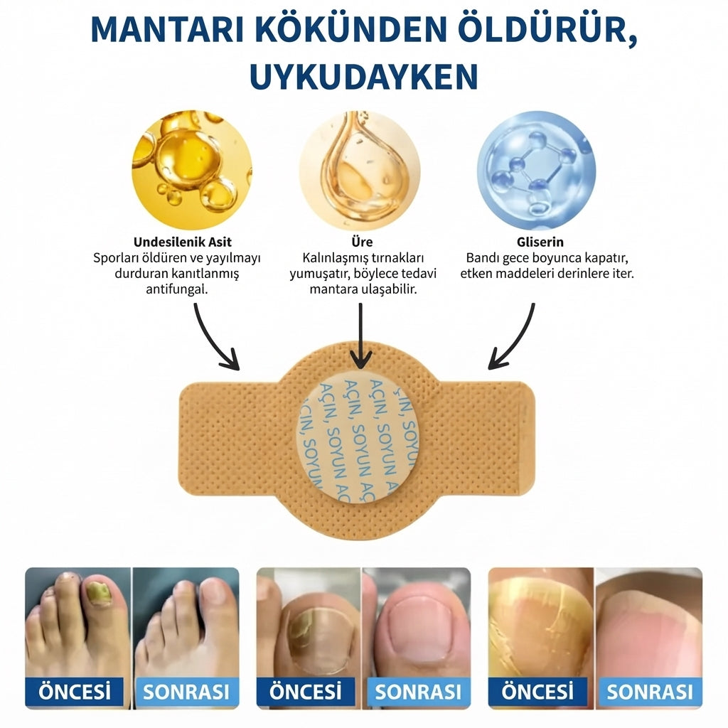 Nailofix® Mantarlı Tırnak Bakım Bandı